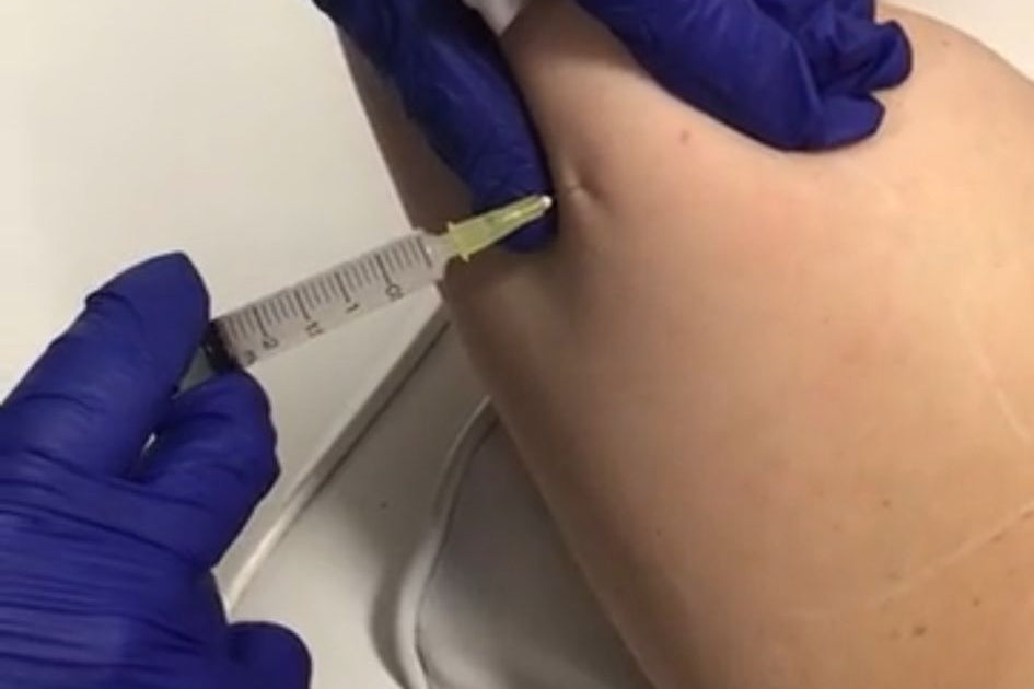 Fat dissolving AQUALYX online manual